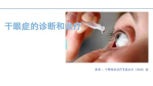 干眼症(2013版)