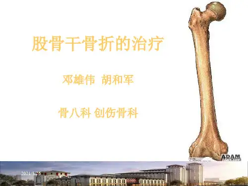 《股骨干骨折骨折》PPT课件