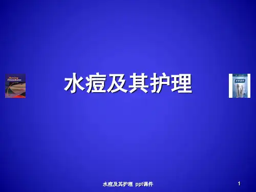 水痘及其护理 ppt课件