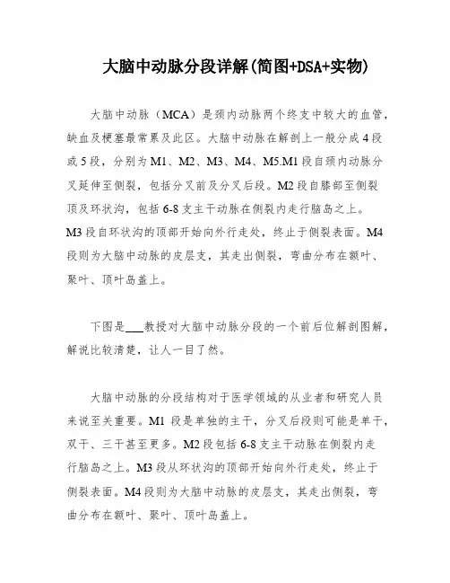 大脑中动脉分段详解(简图+DSA+实物)