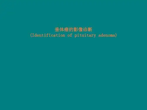 垂体瘤的影像诊断ppt课件
