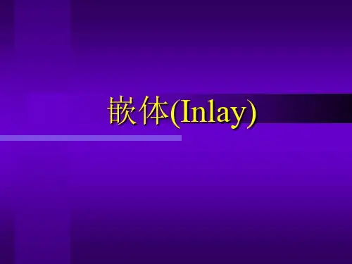 嵌体