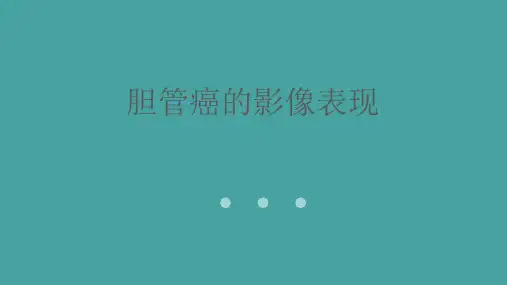 胆管癌的影像表现