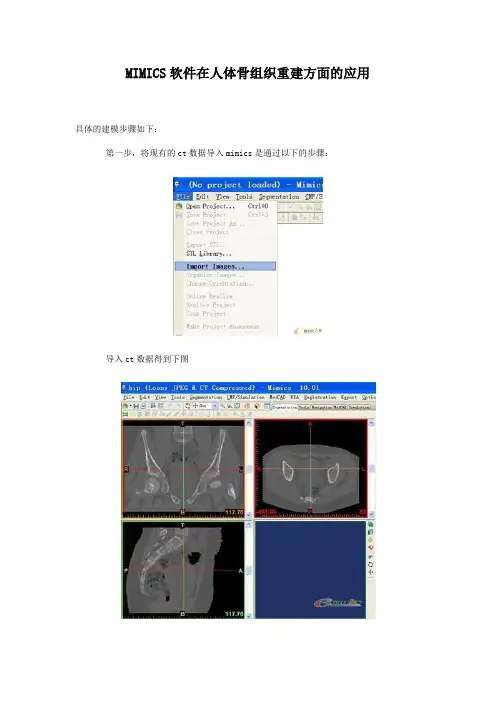 MIMICS软件在人体骨组织重建方面的应用