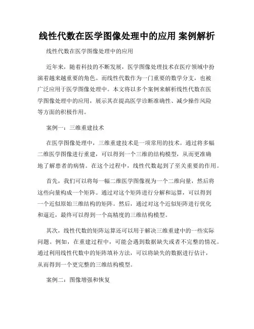线性代数在医学图像处理中的应用 案例解析