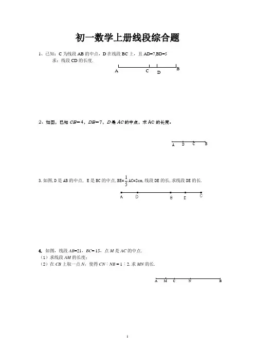 初一数学上册线段综合题