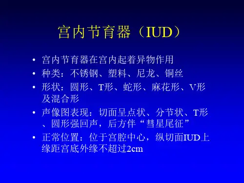 宫内节育器PPT课件