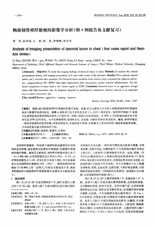 胸部韧带样纤维瘤的影像学分析(附4例报告及文献复习)