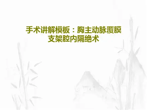 手术讲解模板：胸主动脉覆膜支架腔内隔绝术共66页