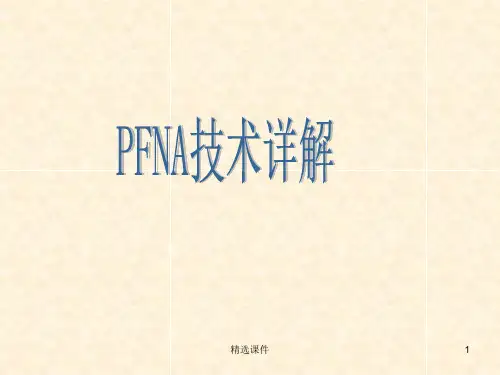 《PFNA技术详解》
