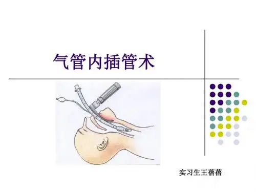 气管内插管术小讲课