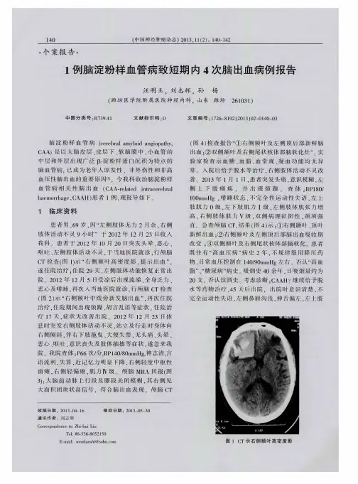 1例脑淀粉样血管病致短期内4次脑出血病例报告