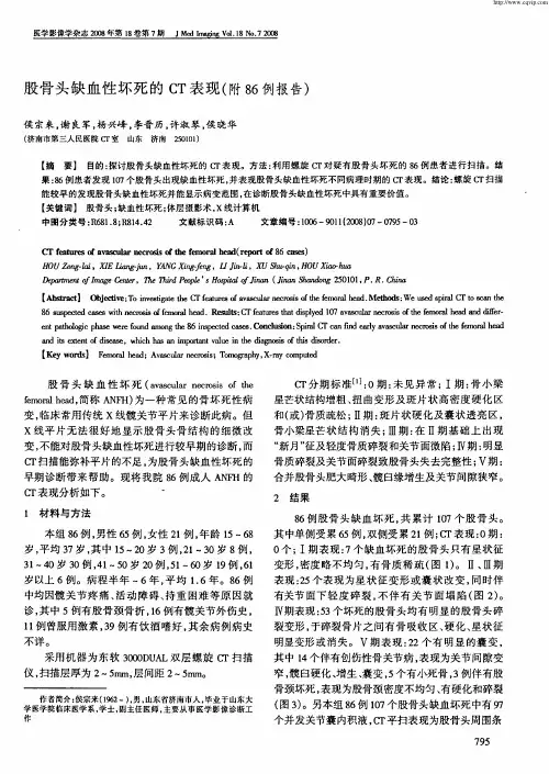 股骨头缺血性坏死的CT表现(附86例报告)