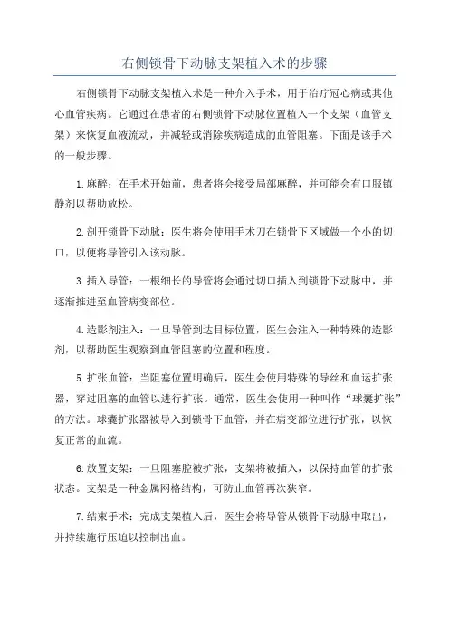 右侧锁骨下动脉支架植入术的步骤 2