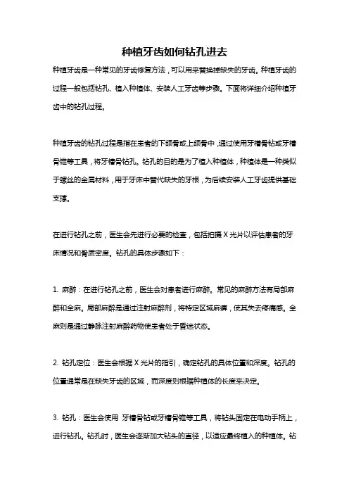 种植牙齿如何钻孔进去