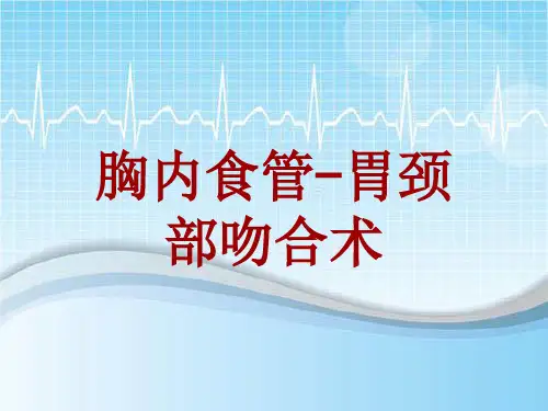 手术讲解模板：胸内食管-胃颈部吻合术