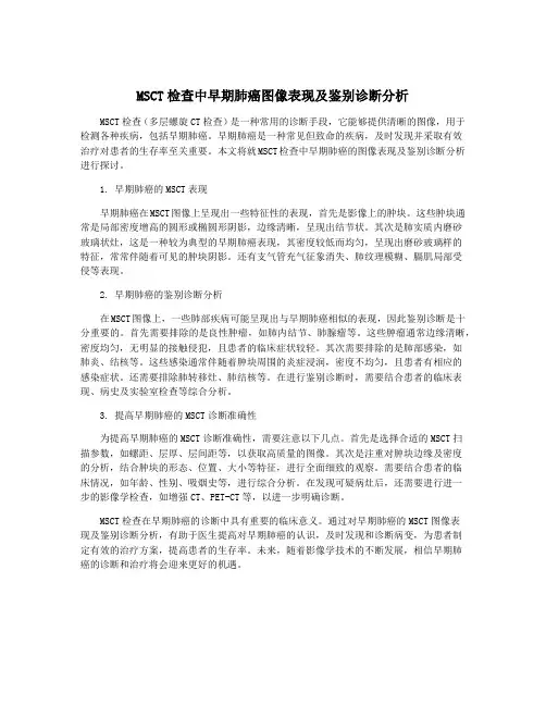 MSCT检查中早期肺癌图像表现及鉴别诊断分析