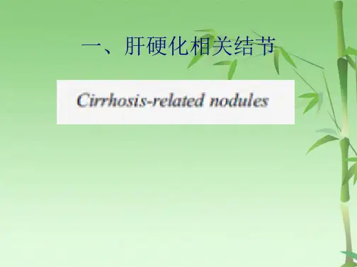 肝脏局灶性病变的特异性造影剂普美显MR表现(共122张PPT)