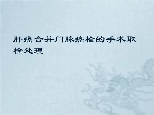 肝癌合并门脉癌栓ppt课件