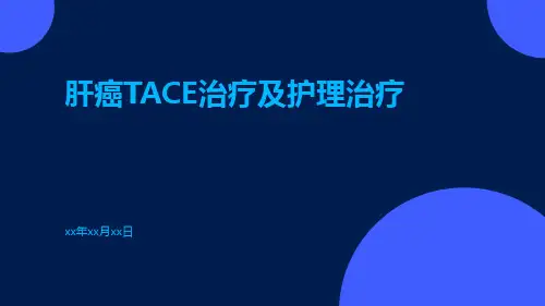 肝癌TACE治疗及护理治疗