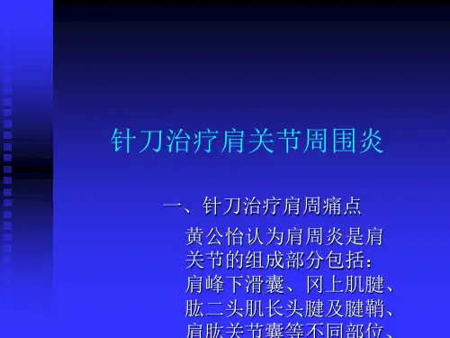 针刀治疗肩周炎