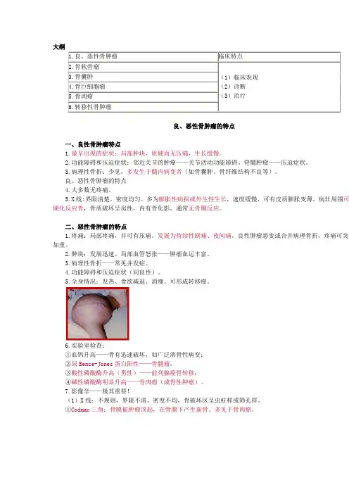 骨肿瘤