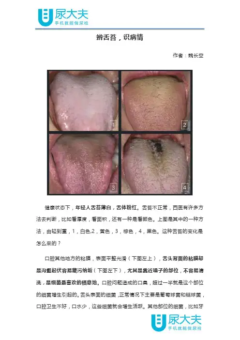 辨舌苔,识病情