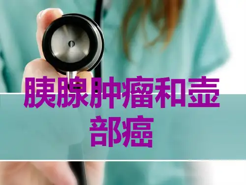 胰腺癌Microsoft PowerPoint 幻灯片 (3)