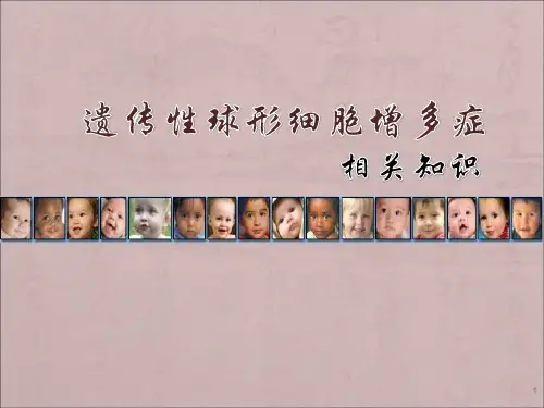遗传性球形红细胞增多症相关知识PPT课件