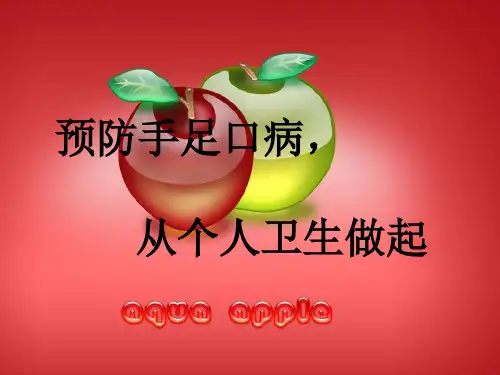 手足口病课件PPT