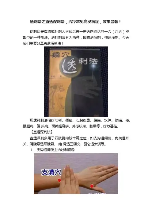 透刺法之直透深刺法，治疗常见高发病症，效果显著！