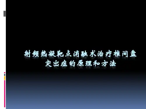 射频热凝靶点消融术治疗椎间盘突出