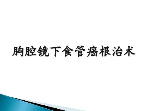 胸腔镜下食管癌根治术