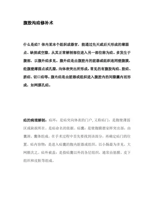 腹股沟疝修补术