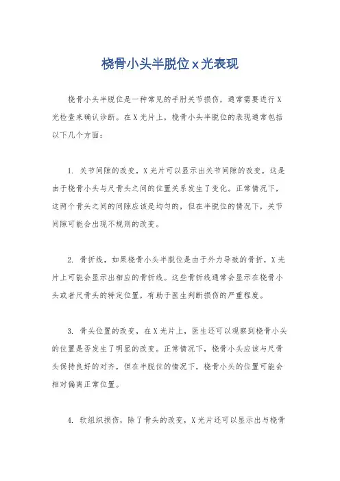 桡骨小头半脱位x光表现
