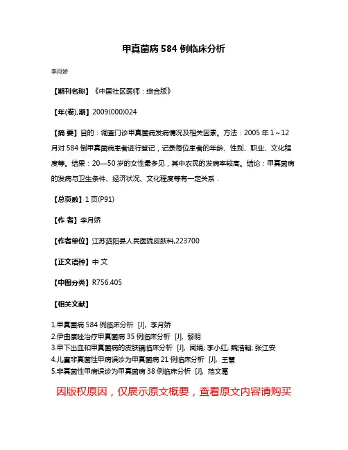 甲真菌病584例临床分析