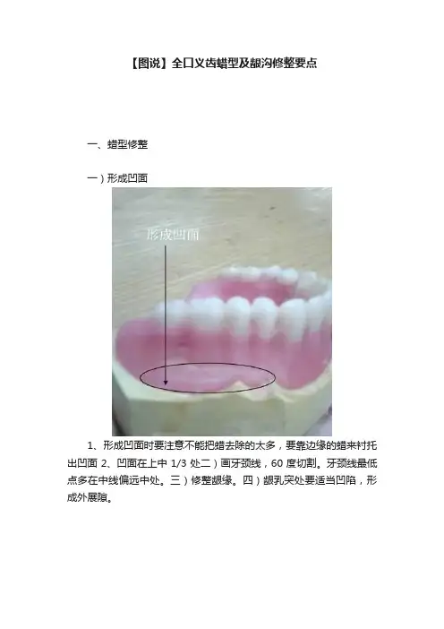 【图说】全口义齿蜡型及龈沟修整要点
