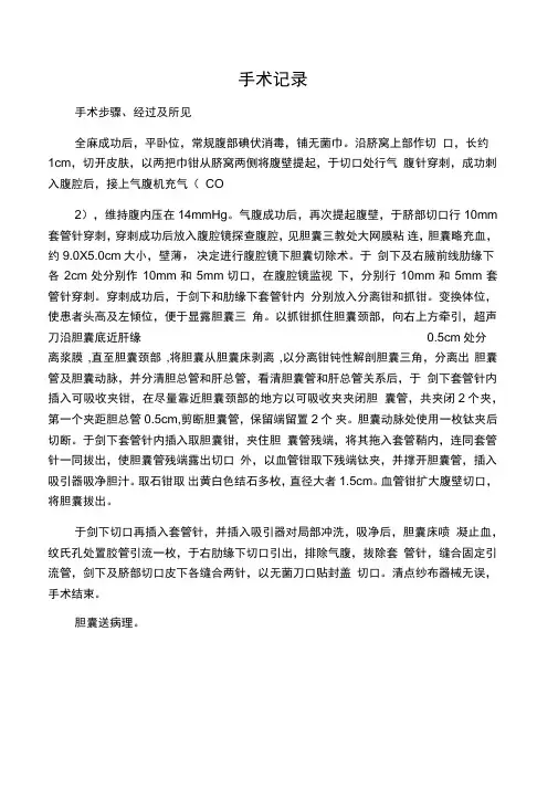 腹腔镜胆囊切除术手术记录