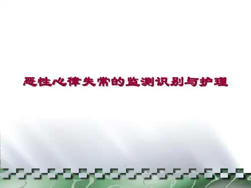 恶性心律失常的监测识别与护理ppt课件
