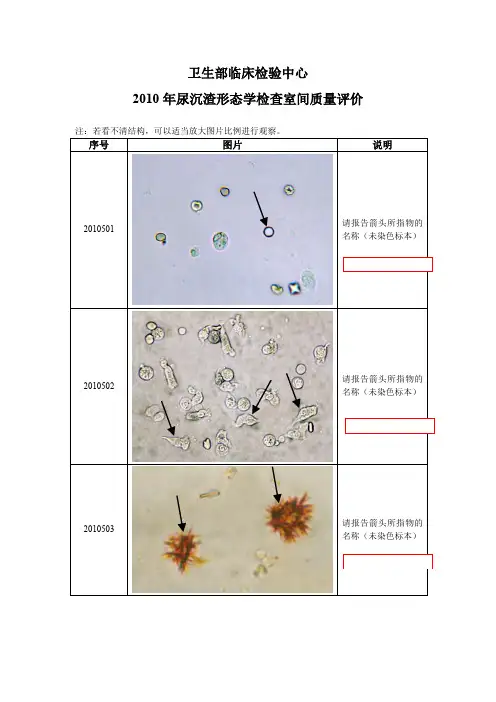 09-17 卫生部 尿液沉渣