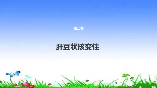 肝豆状核变性