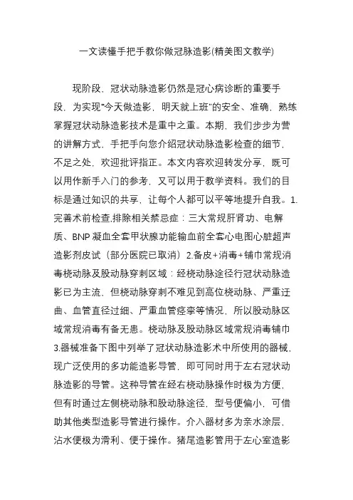 一文读懂手把手教你做冠脉造影(精美图文教学)