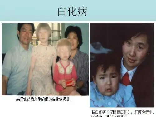基因治疗