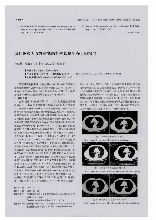 以骨转移为首发症状的肾癌长期生存1例报告