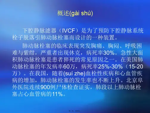 下腔静脉滤器植入取出术规范教程文件