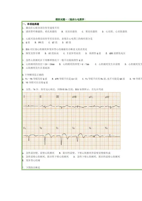 临床医技 心电图模拟试题(总)