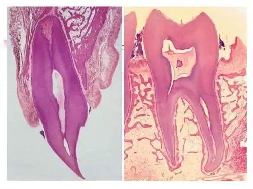 牙周组织(PERIODONTAL TISSUES)ppt课件