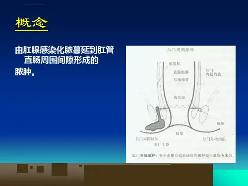 肛门直肠周围脓肿ppt课件