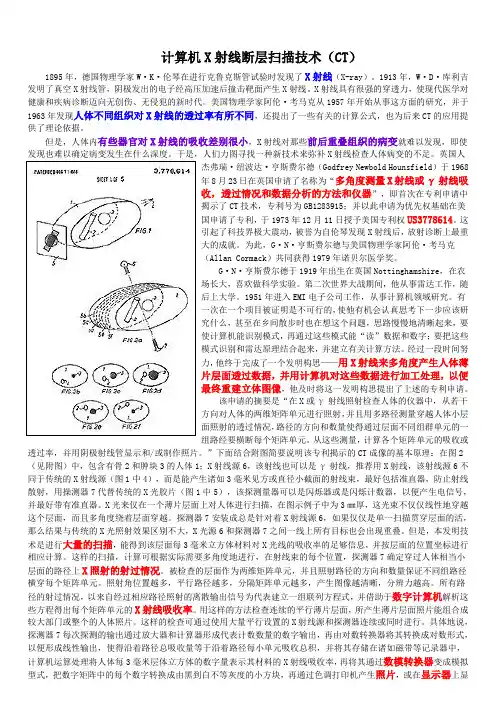计算机X射线断层扫描技术CT