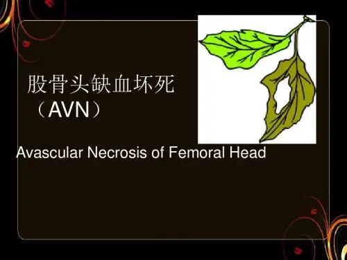 股骨头缺血坏死  ppt课件